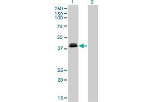 Western Blot analysis of OTX1 expression in transfected 293T cell line by OTX1 monoclonal antibody (M01), clone 1F2. (OTX1 antibody  (AA 10-116))