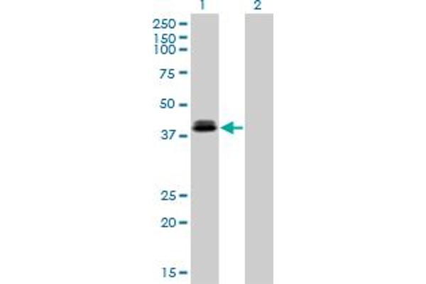 OTX1 Antikörper  (AA 10-116)