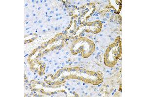 Immunohistochemistry of paraffin-embedded rat kidney using ABL1 antibody.