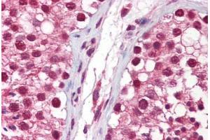 Anti-NANOS1 antibody IHC staining of human testis. (Nanos Homolog 1 antibody  (AA 50-100))