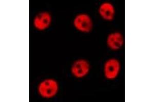ABIN6278597 staining Hela by IF/ICC. (NOL8 antibody  (C-Term))