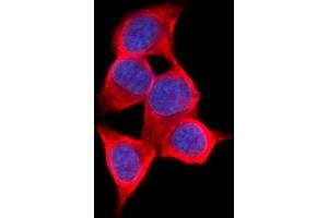 IF analysis of AKR1C1/C2 using anti-AKR1C1/C2 antibody (ABIN5692785). (AKR1C2 antibody  (AA 1-123))