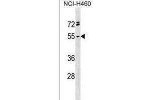 RG Antibody (C-term) (ABIN1537257 and ABIN2838199) western blot analysis in NCI- cell line lysates (35 μg/lane). (RGMA antibody  (C-Term))