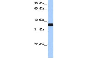 WB Suggested Anti-OCEL1 Antibody Titration:  0. (OCEL1 antibody  (C-Term))