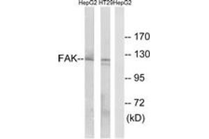 Western blot analysis of extracts from HepG2/HT-29 cells, using FAK (Ab-397) Antibody. (FAK antibody  (AA 363-412))