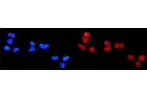IF analysis of DDB2 using anti-DDB2 antibody (ABIN3043488).
