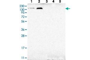 Western blot analysis of Lane 1: RT-4, Lane 2: U-251 MG, Lane 3: Human Plasma, Lane 4: Liver, Lane 5: Tonsil with CEP192 polyclonal antibody  at 1:250-1:500 dilution. (CEP192 antibody)