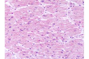Anti-Neurokinin 1 Receptor / NK1R antibody IHC of human heart. (TACR1 antibody  (C-Term))
