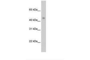 Image no. 1 for anti-Protein Arginine Methyltransferase 8 (PRMT8) (C-Term) antibody (ABIN204960) (PRMT8 antibody  (C-Term))