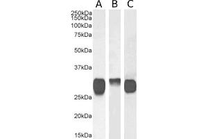 Western Blot using anti-HLA class II histocompatibility antigen DR antibody F3. (Recombinant HLA Class II antibody)