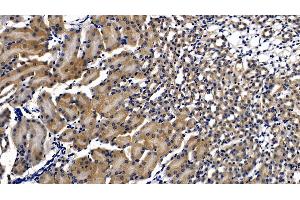 Detection of MyD88 in Mouse Kidney Tissue using Polyclonal Antibody to Myeloid Differentiation Factor 88 (MyD88) (MYD88 antibody  (AA 32-265))