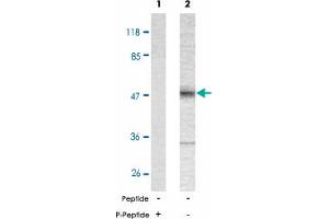 Western blot analysis of extract from mouse brain tissue using MAPT (phospho T181) polyclonal antibody . (MAPT antibody  (pThr181))