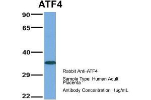 Host:  Rabbit  Target Name:  ATF4  Sample Type:  Human Adult Placenta  Antibody Dilution:  1. (ATF4 antibody  (Middle Region))