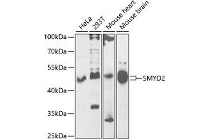 Western blot analysis of extracts of various cell lines, using SMYD2 antibody (ABIN6130910, ABIN6148167, ABIN6148168 and ABIN6222133) at 1:1000 dilution. (SMYD2A antibody  (AA 1-270))