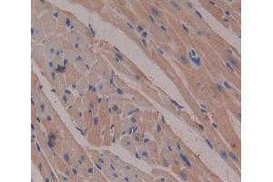 Used in DAB staining on fromalin fixed paraffin- embedded heart tissue (Esophageal Cancer Related Gene 4 (AA 32-148) antibody)