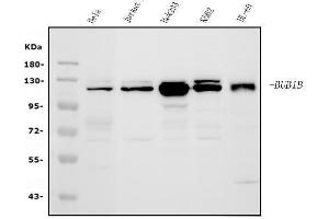 Western blot analysis of BubR1/BUB1B using anti-BubR1/BUB1B antibody (ABIN7600962).