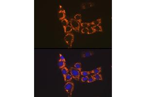 Immunofluorescence analysis of NIH-3T3 cells using H2-Ab1 Rabbit pAb (ABIN7267665) at dilution of 1:100 (40x lens). (H2-AB1 antibody)