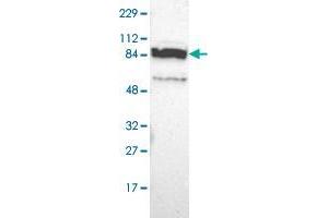 Western blot analysis of Human cell line RT-4 with PPFIBP2 polyclonal antibody  at 1:100-1:250 dilution. (PPFIBP2 antibody)