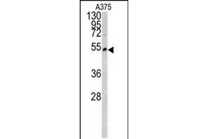 Western blot analysis of LUM antibody in A375 cell line lysates (35ug/lane)