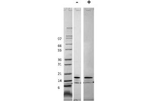 SDS-PAGE (SDS) image for Chemokine (C-C Motif) Ligand 2 (CCL2) protein (ABIN6699610)