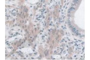 IHC-P analysis of Mouse Uterus Tissue, with DAB staining. (GLP1R antibody  (AA 25-145))