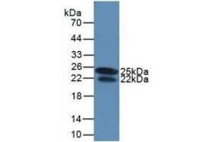 Detection of Recombinant IFNg, Human using Monoclonal Antibody to Interferon Gamma (IFNg) (Interferon gamma antibody  (AA 24-166))