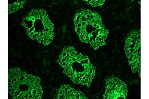KRT8 antibody