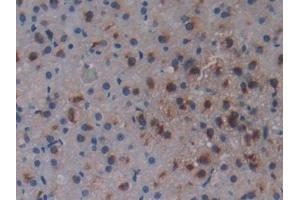 DAB staining on IHC-P; Samples: Rat Adrenal Gland Tissue (Osteopontin antibody  (AA 17-317))