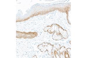 Immunohistochemistry (IHC) image for anti-Keratin 5 (KRT5) (C-Term) antibody (ABIN7795755)