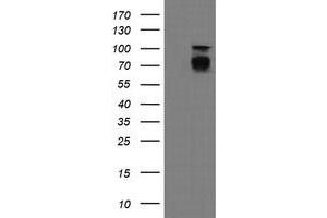 Image no. 6 for anti-Differentially Expressed in FDCP 6 Homolog (DEF6) antibody (ABIN1497808)