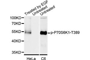 Western blot analysis of extracts of various cell lines, using Phospho-P70S6K1-T389 antibody. (RPS6KB1 antibody)