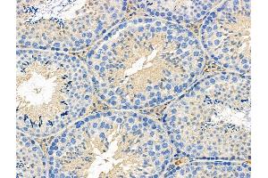 ABIN6258840 and ABIN6276280 at 1/100 staining Mouse testis tissue by IHC-P. (HCRTR1 antibody  (C-Term))