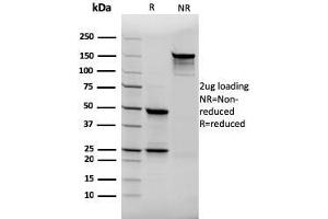 SDS-PAGE Analysis Purified Thyroglobulin Mouse Recombinant Monoclonal Antibody (rTGB24). (Recombinant Thyroglobulin antibody)