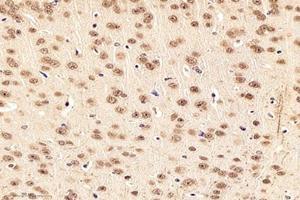 Immunohistochemistry analysis of paraffin-embedded mouse striatumusing,NOS1AP (ABIN7074844) at dilution of 1:4000 (NOS1AP antibody)
