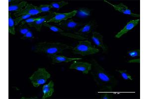 Immunofluorescence of monoclonal antibody to APOM on HeLa cell. (Apolipoprotein M antibody  (AA 23-188))