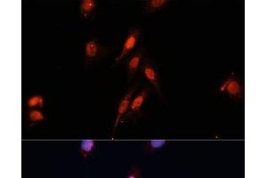 Immunofluorescence analysis of HeLa cells using Smad5 Polyclonal Antibody at dilution of 1:100 (40x lens). (SMAD5 antibody)