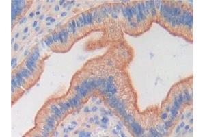 Detection of FGF6 in Mouse Uterus Tissue using Polyclonal Antibody to Fibroblast Growth Factor 6 (FGF6)