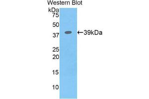 Western Blotting (WB) image for anti-Colony Stimulating Factor 2 Receptor, Beta (CSF2RB) (AA 133-233) antibody (ABIN1858513) (CD131 antibody  (AA 133-233))