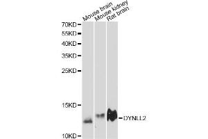 Western blot analysis of extracts of various cell lines, using DYNLL2 antibody (ABIN6292037) at 1:3000 dilution.