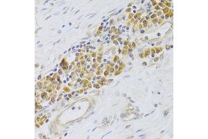 Immunohistochemistry of paraffin-embedded human esophagus using PA2G4 Antibody (ABIN5973112) at dilution of 1/100 (40x lens). (PA2G4 antibody)