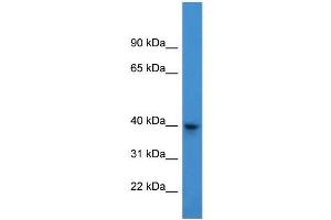 Human 293T; WB Suggested Anti-ARPM1 Antibody Titration: 0. (ARPM1 antibody  (N-Term))