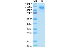 SDS-PAGE (SDS) image for Interleukin 31 Receptor A (IL31RA) (AA 20-519) protein (His tag) (ABIN7275018)
