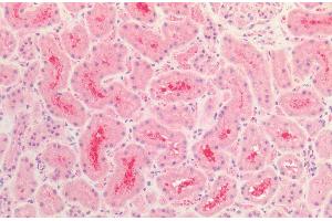 Immunohistochemistry analysis using Rabbit Anti-Tau Polyclonal Antibody (ABIN6698780). (tau antibody  (PerCP))