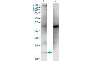 Western Blot analysis of CLPS expression in transfected 293T cell line by CLPS monoclonal antibody (M05), clone 4G3.