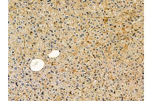 ABIN7095288 and ABIN7099345 at 1/100 staining mouse liver tissue by IHC-P. (SOCS5 antibody)
