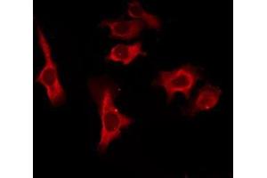 ABIN6277037 staining HepG2 by IF/ICC. (CD83 antibody  (Internal Region))