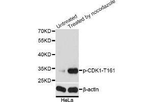 Western blot analysis of extracts of HeLa cells, using Phospho-CDK1-T161 antibody (ABIN5969957) at 1/2000 dilution. (CDK1 antibody  (pThr161))