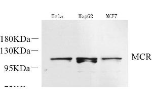 Western Blot analysis of various samples using Mineralocorticoid receptor Polyclonal Antibody at dilution of 1:600.