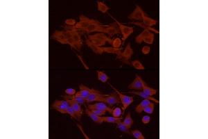 Immunofluorescence (IF) image for anti-phosphorylase, Glycogen, Brain (GPBB) (AA 544-843) antibody (ABIN6146522)