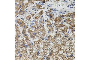Immunohistochemistry of paraffin-embedded human liver injury using NTF3 antibody (ABIN6290617) (40x lens). (Neurotrophin 3 antibody)